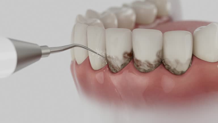 Trusted Tooth Extraction service in Caledonia, MI - Dentist Open Now